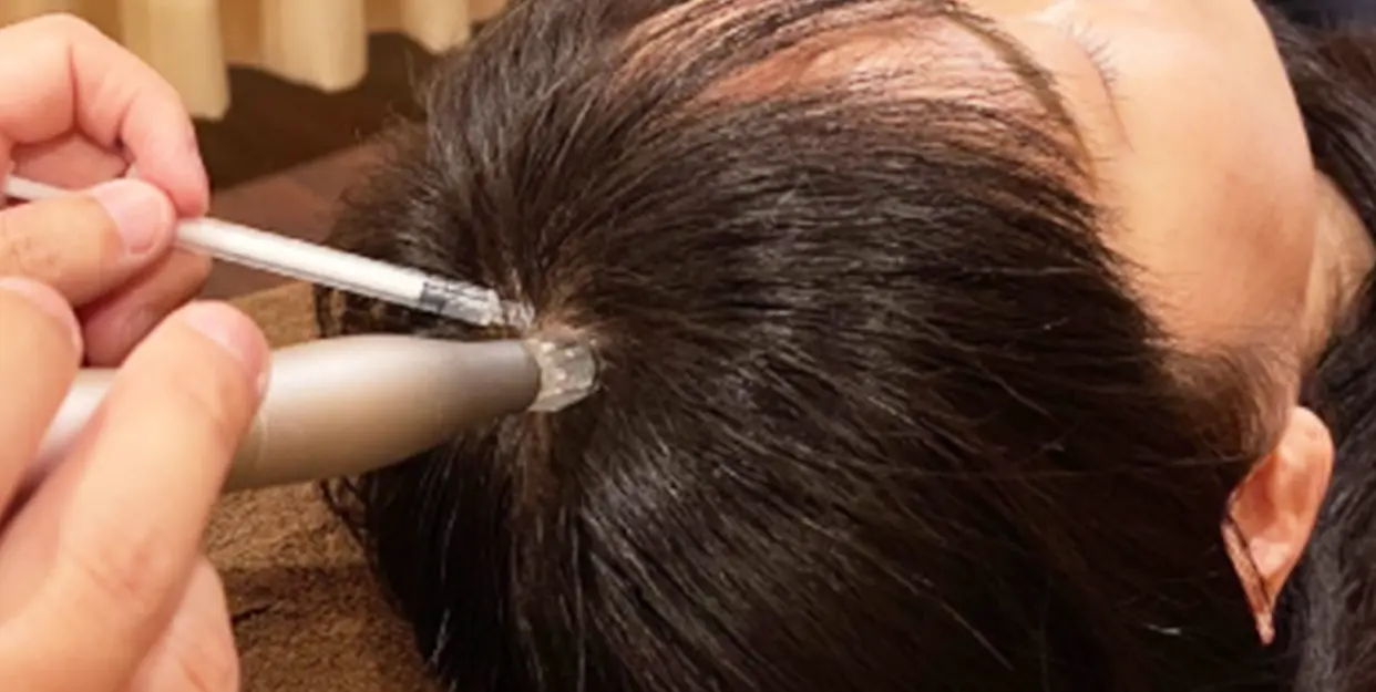 発毛サロン特徴１